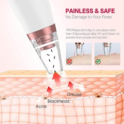 Picture of Electric Vacuum Electric Acne / Blackhead Remover Extractor 6 Suction Head Beauty Machine For Skin Care