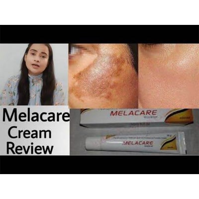 Picture of International MELACARE Hydroquinone, Tretinoin and Mometasone Furoate Cream 25g - Multicolor