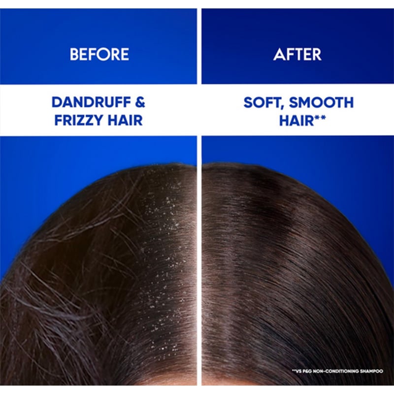 Picture of Head & Shoulders 2-in-1 Smooth and Silky Anti Dandruff Shampoo + Conditioner for Women & Men, With Almond Milk (1 L)