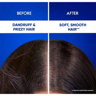 Picture of Head & Shoulders 2-in-1 Smooth and Silky Anti Dandruff Shampoo + Conditioner for Women & Men, With Almond Milk (1 L)