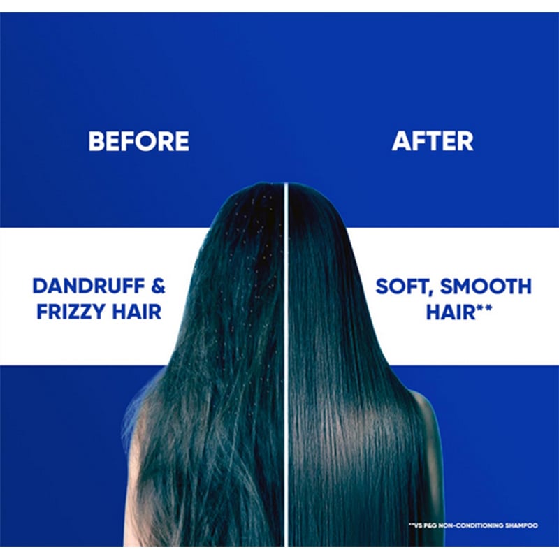 Picture of Head & Shoulders 2-in-1 Smooth and Silky Anti Dandruff Shampoo + Conditioner for Women & Men, With Almond Milk (1 L)