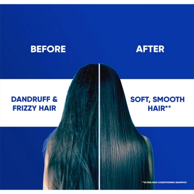 Picture of Head & Shoulders 2-in-1 Smooth and Silky Anti Dandruff Shampoo + Conditioner for Women & Men, With Almond Milk (1 L)