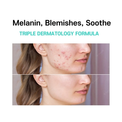 Picture of Melasma Treatment for Face Cream - Dark Spot Remover Centella Asiatica - Korean Skin Care Beauty Products 40ml