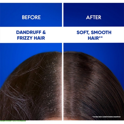 Picture of Head & Shoulders 2-in-1 Cool Menthol Anti Dandruff Shampoo + Conditioner for Women & Men, With Almond Milk (1 L)