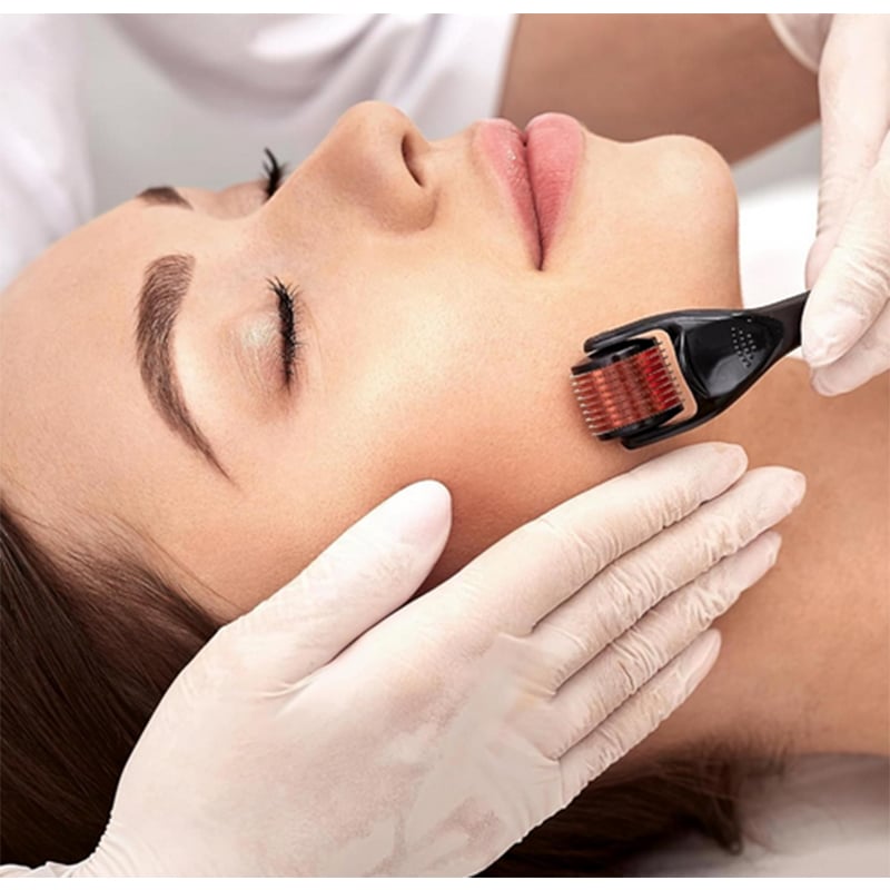 Picture of 540 Titanium Microneedle Derma Roller 0.5mm: For Hair Growth, Acne, Wrinkle, and Scar Treatment